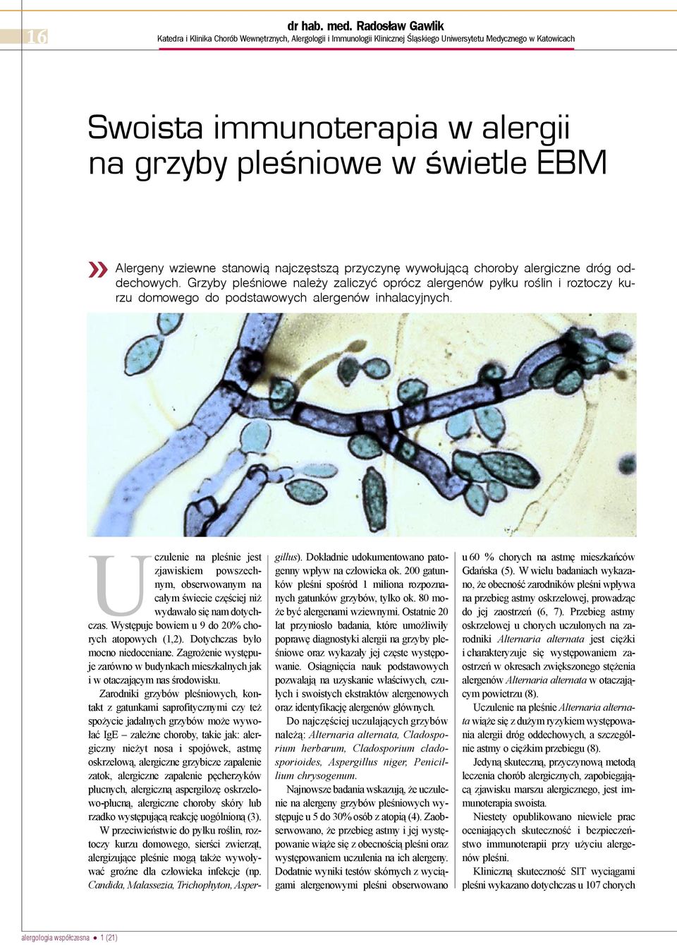 œwietle EBM Alergeny wziewne stanowi¹ najczêstsz¹ przyczynê wywo³uj¹c¹ choroby alergiczne dróg oddechowych.