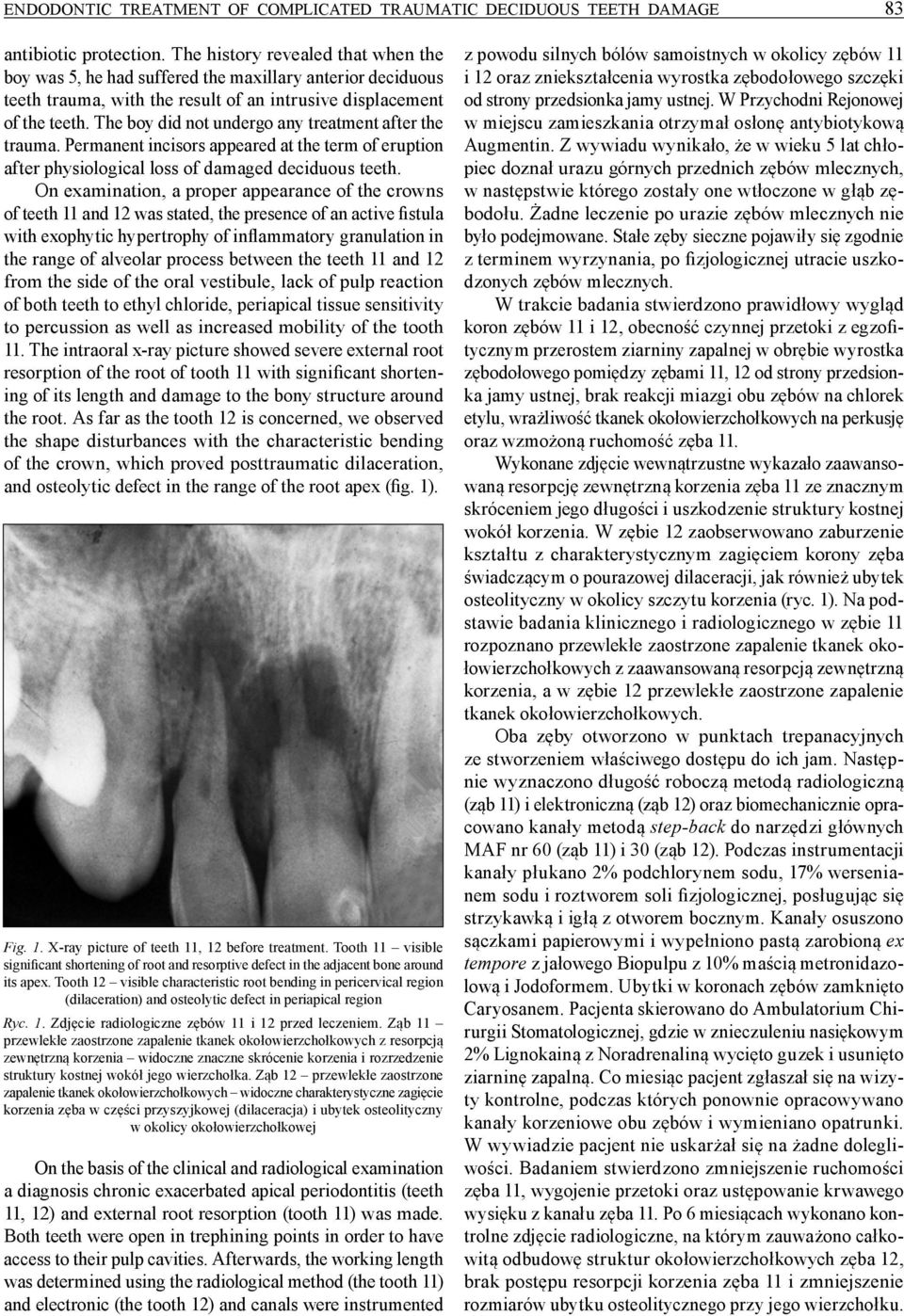 The boy did not undergo any treatment after the trauma. Permanent incisors appeared at the term of eruption after physiological loss of damaged deciduous teeth.