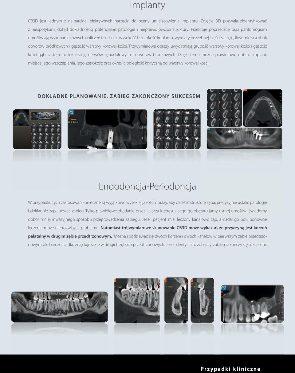 Przekroje poprzeczne oraz pantomogram umożliwiają wykonanie różnych obliczeń takich jak: wysokość i szerokość implantu, wymiary bezzębnej części szczęki, ilość miejsca obok otworów bródkowych i