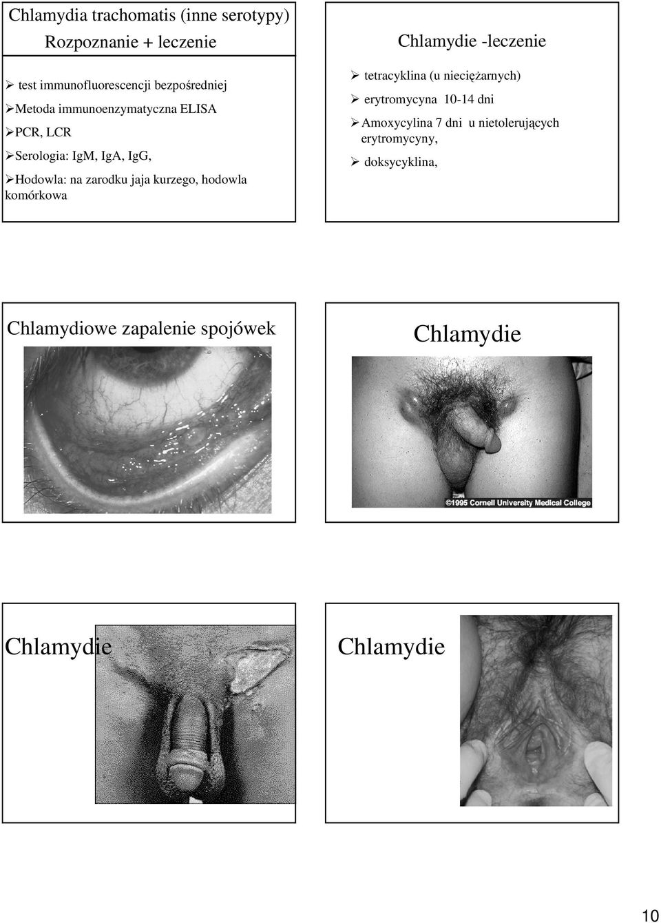 hodowla komórkowa Chlamydie -leczenie tetracyklina (u niecięŝarnych) erytromycyna 10-14 dni Amoxycylina