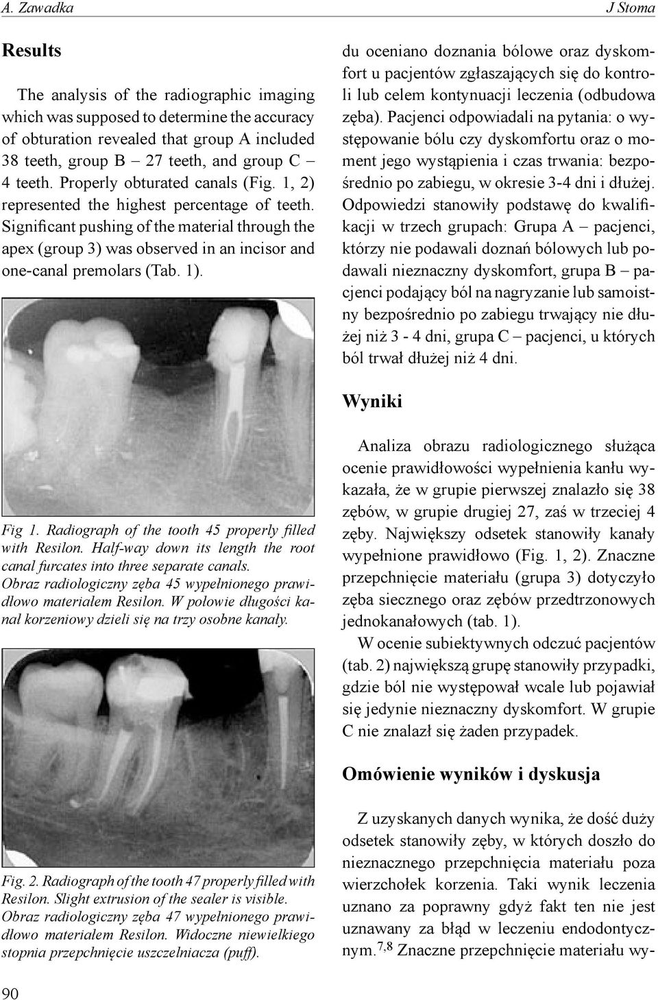 Significant pushing of the material through the apex (group 3) was observed in an incisor and one-canal premolars (Tab. 1).