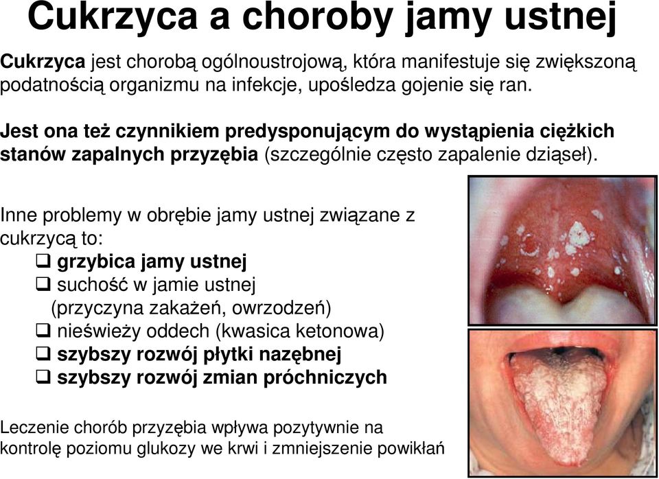 Inne problemy w obrębie jamy ustnej związane z cukrzycą to: grzybica jamy ustnej suchość w jamie ustnej (przyczyna zakaŝeń, owrzodzeń) nieświeŝy oddech