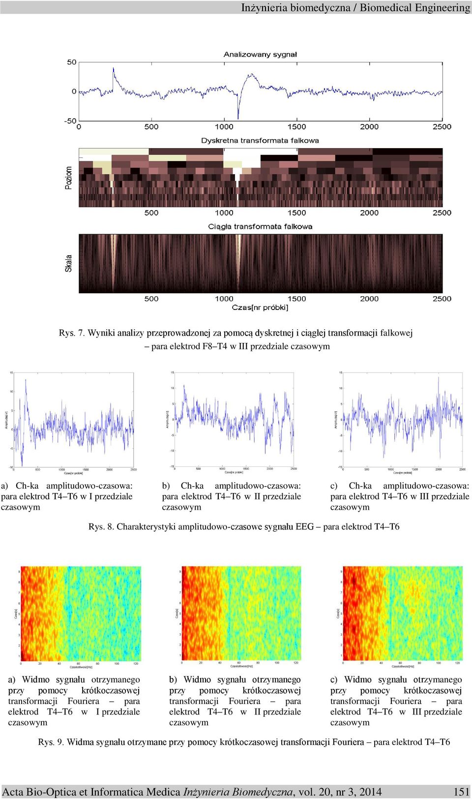 amplitudowo-czasowa: para elektrod T4 T6 w II przedziale c) Ch-ka amplitudowo-czasowa: para elektrod T4 T6 w III przedziale Rys. 8.