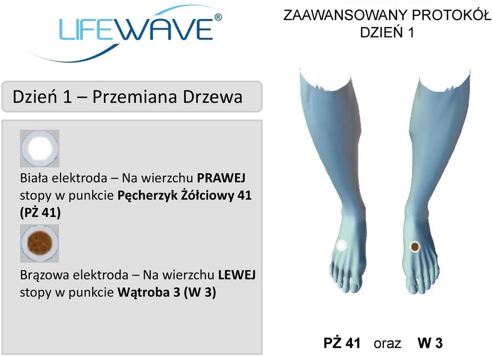 Pęcherzyk Żółciowy 41 (PŻ 41) Brązowa elektroda Na wierzchu