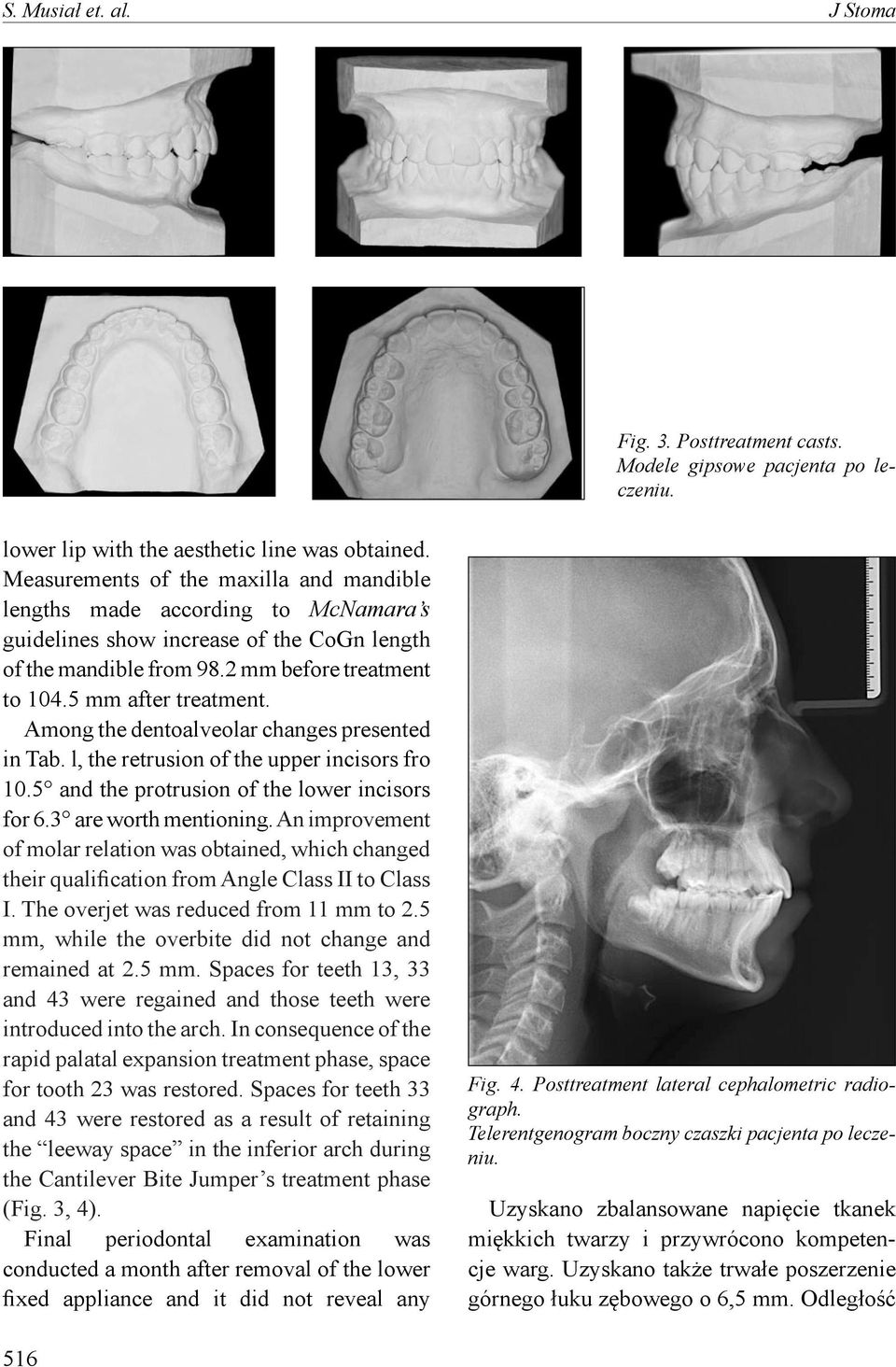 Among the dentoalveolar changes presented in Tab. l, the retrusion of the upper incisors fro 10.5 and the protrusion of the lower incisors for 6.3 are worth mentioning.