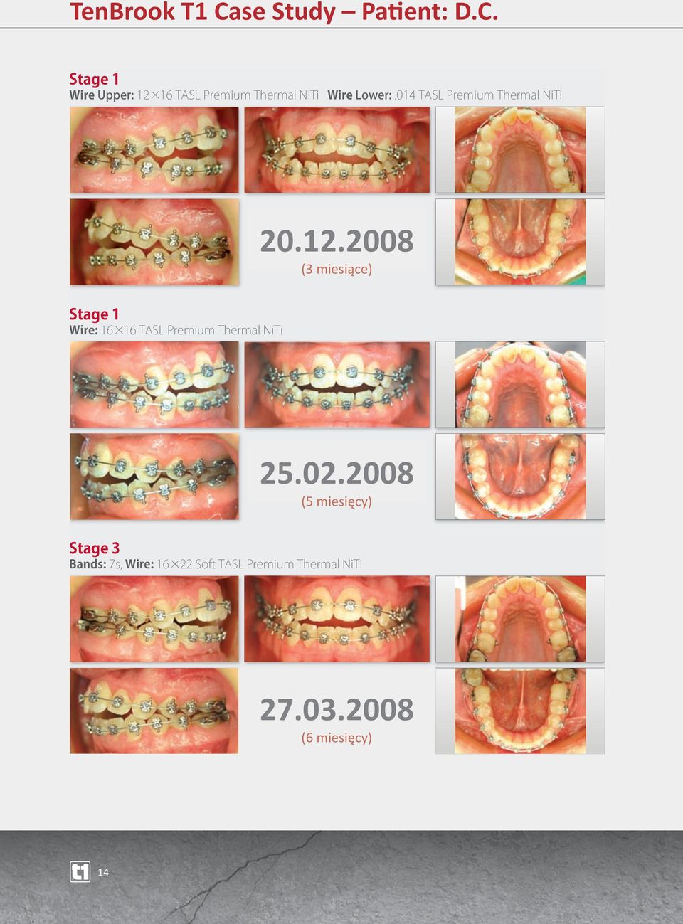 2008 (3 miesiące) 25.02.