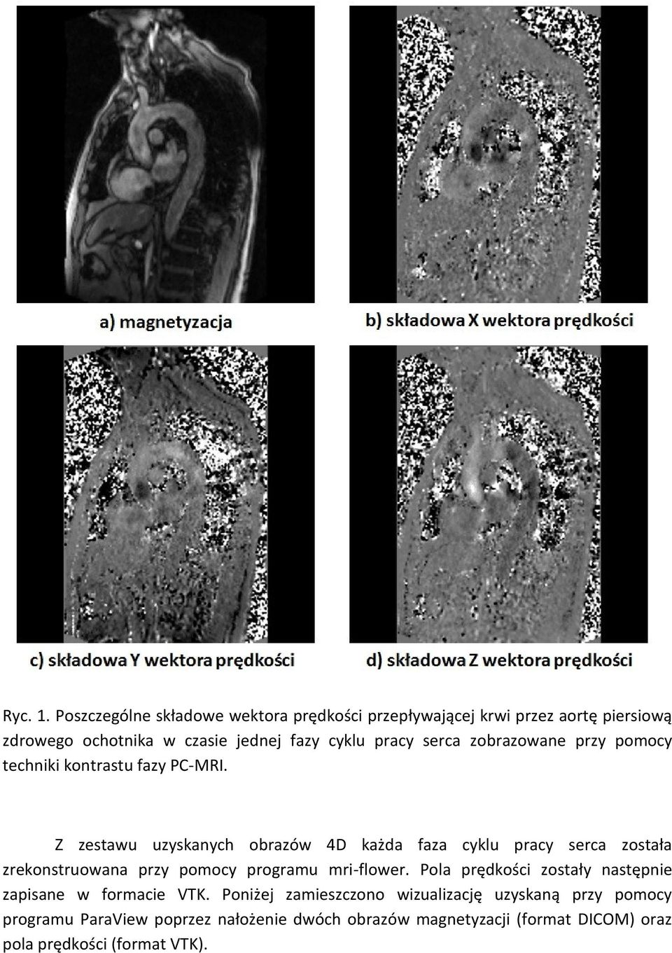 serca zobrazowane przy pomocy techniki kontrastu fazy PC-MRI.