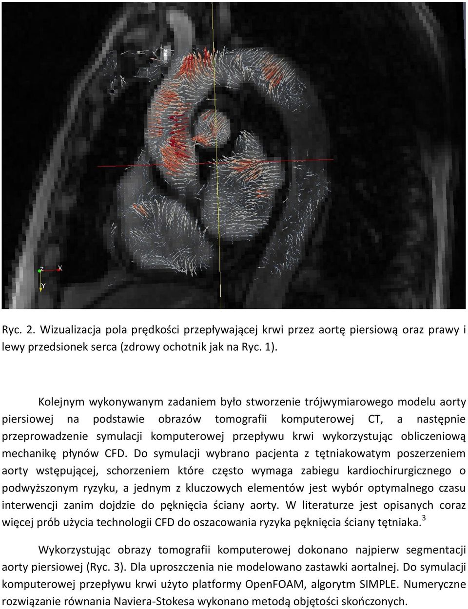 krwi wykorzystując obliczeniową mechanikę płynów CFD.