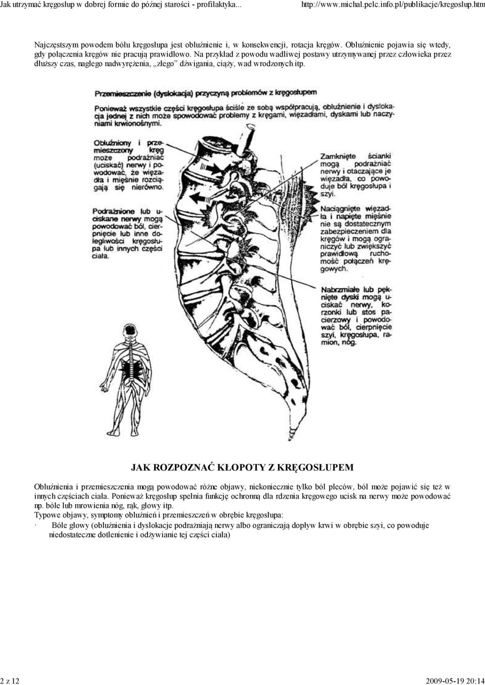 JAK ROZPOZ AĆ KŁOPOTY Z KRĘGOSŁUPEM Obluźnienia i przemieszczenia mogą powodować różne objawy, niekoniecznie tylko ból pleców, ból może pojawić się też w innych częściach ciała.
