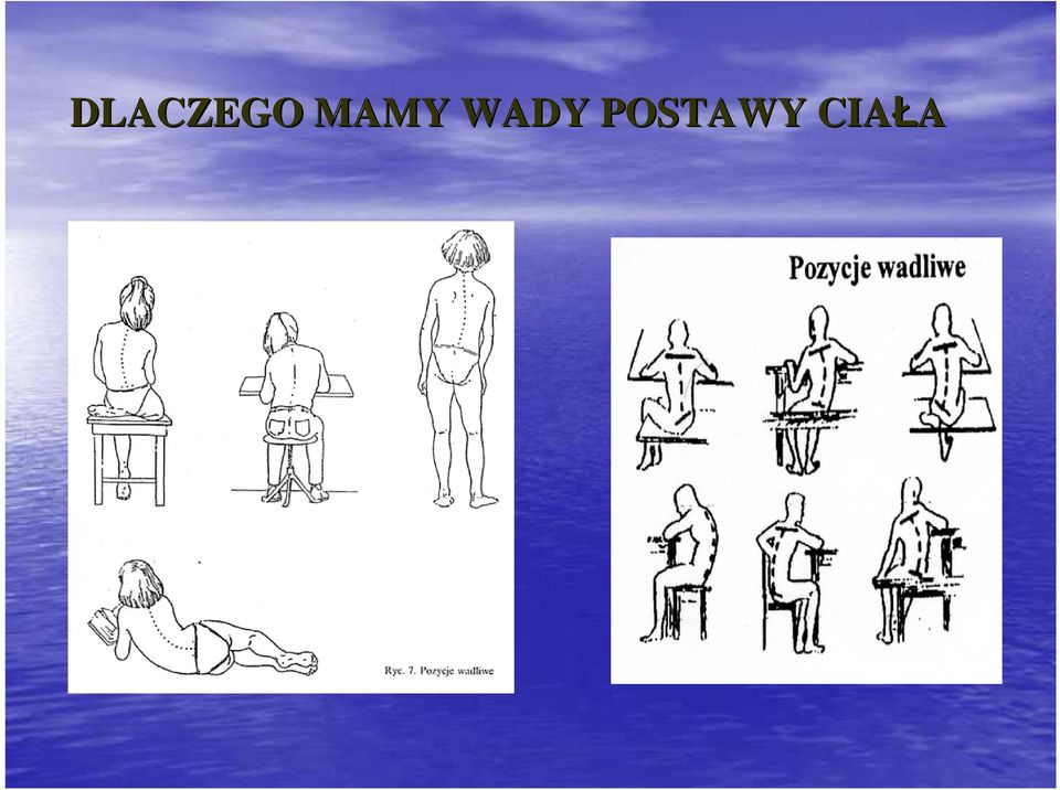 POSTAWY
