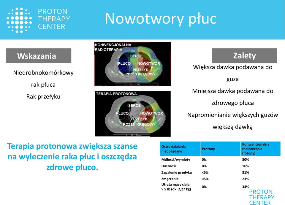 dawką Terapia protonowa zwiększa szanse na wyleczenie raka płuc i oszczędza zdrowe płuco.