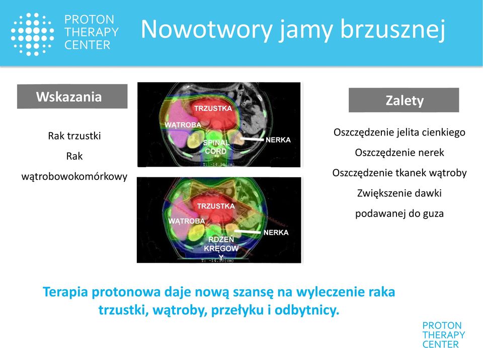 wątroby Zwiększenie dawki WĄTROBA TRZUSTKA podawanej do guza RDZEŃ KRĘGOW Y NERKA