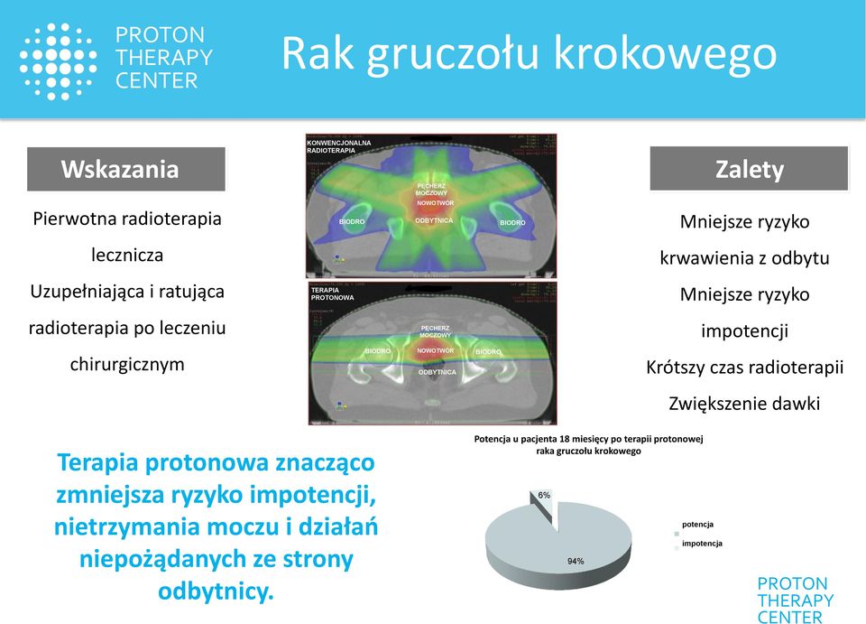 chirurgicznym BIODRO ODBYTNICA BIODRO Krótszy czas radioterapii Zwiększenie dawki Terapia protonowa znacząco zmniejsza ryzyko impotencji,