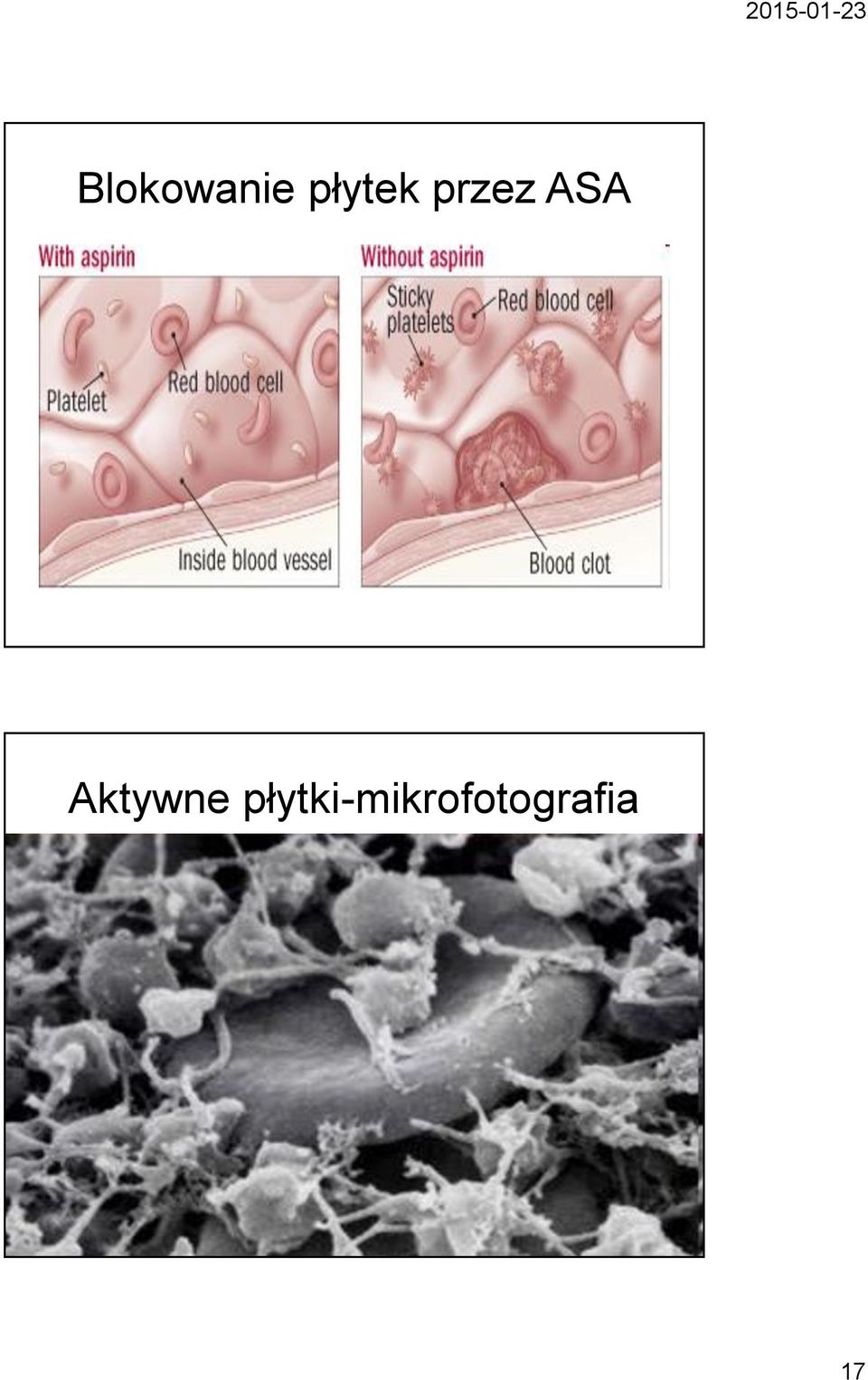 ASA Aktywne