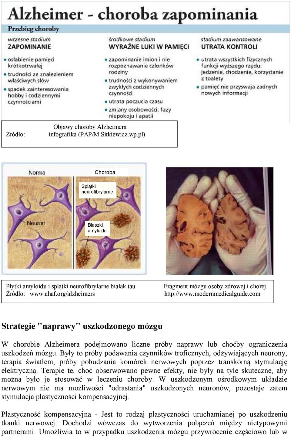 com Strategie "naprawy" uszkodzonego mózgu W chorobie Alzheimera podejmowano liczne próby naprawy lub choćby ograniczenia uszkodzeń mózgu.