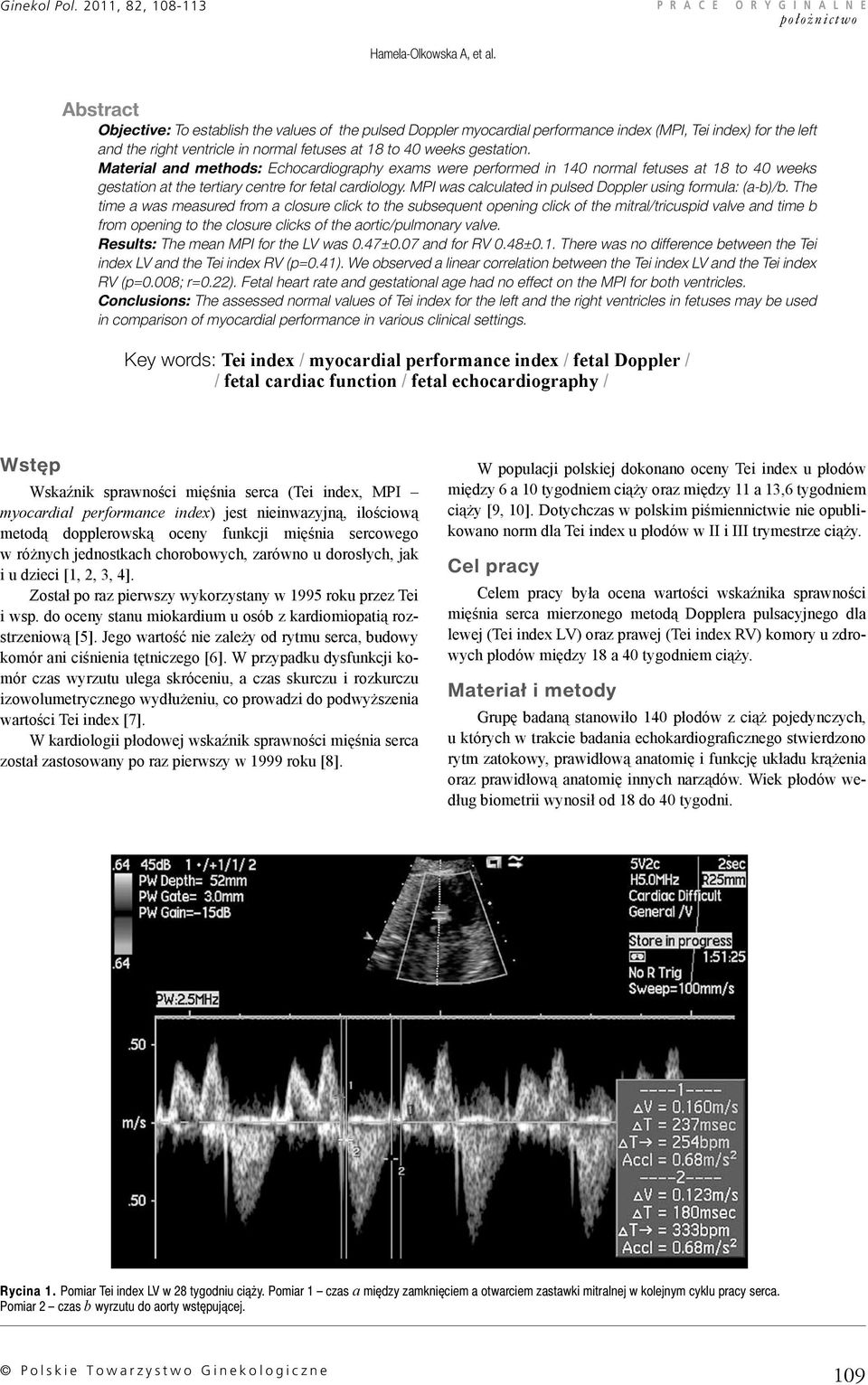 Material and methods: Echocardiography exams were performed in 140 normal fetuses at 18 to 40 weeks gestation at the tertiary centre for fetal cardiology.