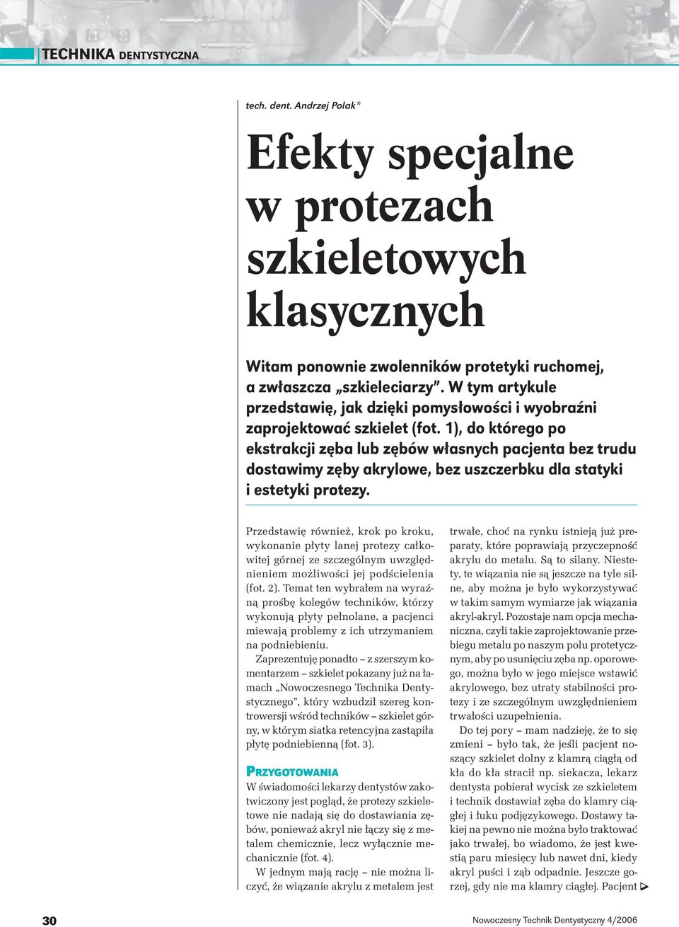 1), do którego po ekstrakcji zęba lub zębów własnych pacjenta bez trudu dostawimy zęby akrylowe, bez uszczerbku dla statyki i estetyki protezy.