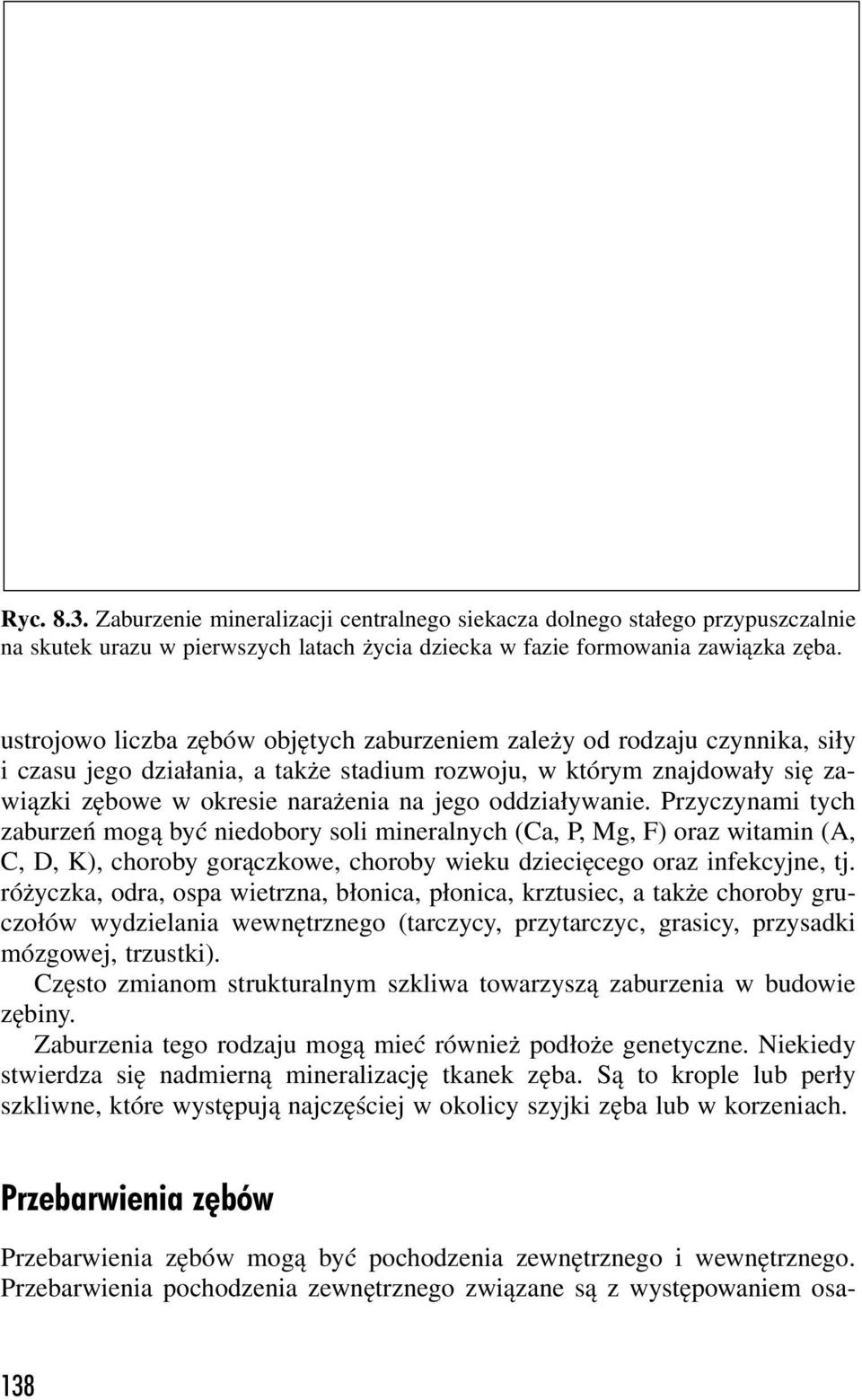 oddziaływanie. Przyczynami tych zaburzeń mogą być niedobory soli mineralnych (Ca, P, Mg, F) oraz witamin (A, C, D, K), choroby gorączkowe, choroby wieku dziecięcego oraz infekcyjne, tj.