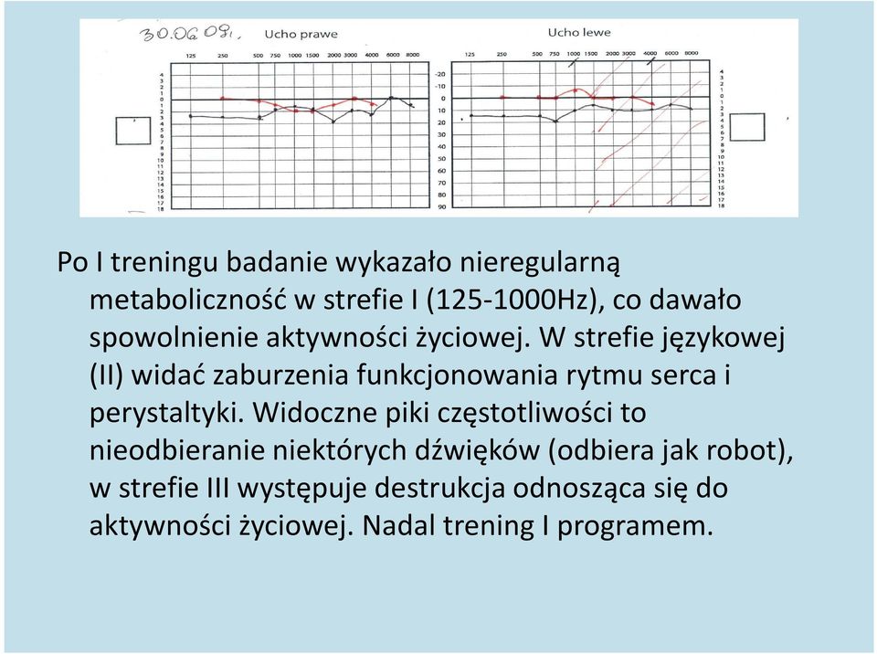 W strefie językowej (II) widać zaburzenia funkcjonowania rytmu serca i perystaltyki.