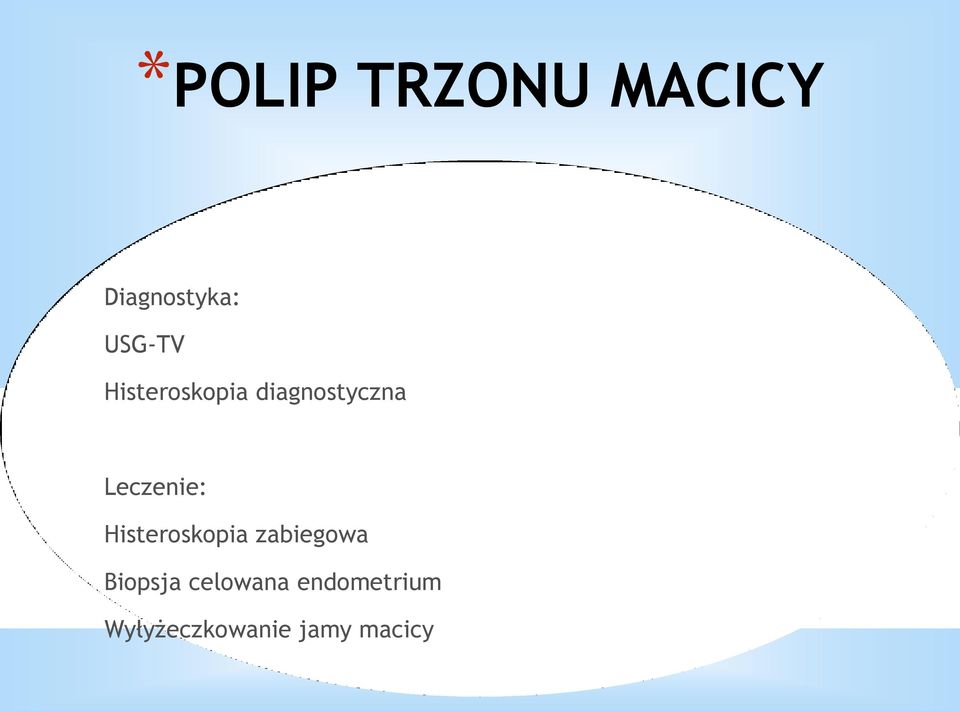 Leczenie: Histeroskopia zabiegowa