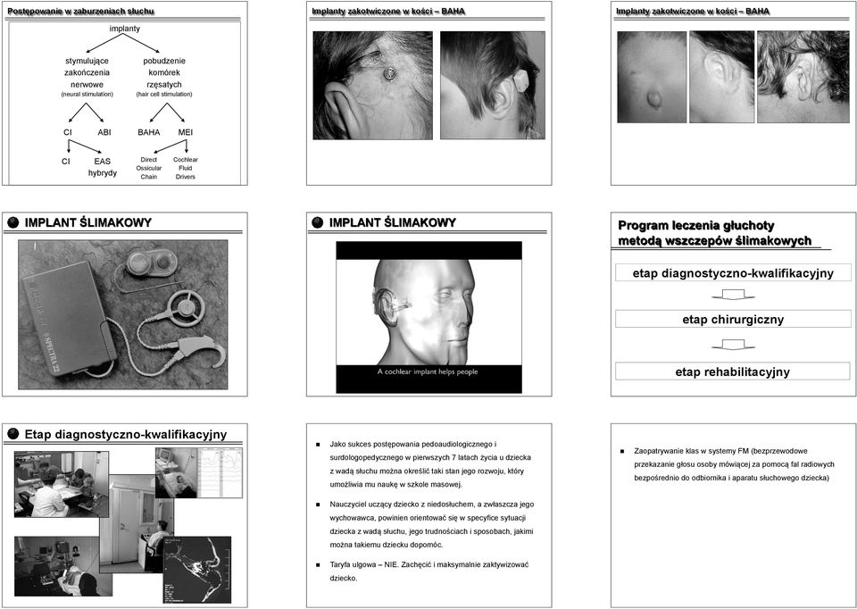 diagnostyczno-kwalifikacyjny etap chirurgiczny etap rehabilitacyjny Etap diagnostyczno-kwalifikacyjny Jako sukces postępowania pedoaudiologicznego i surdologopedycznego w pierwszych 7 latach życia u