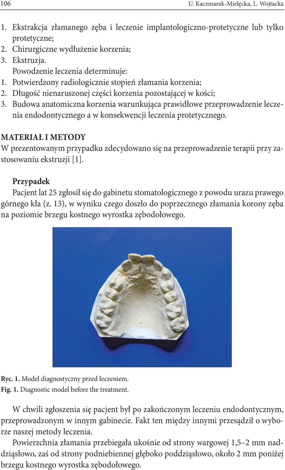 Budowa anatomiczna korzenia warunkująca prawidłowe przeprowadzenie leczenia endodontycznego a w konsekwencji leczenia protetycznego.