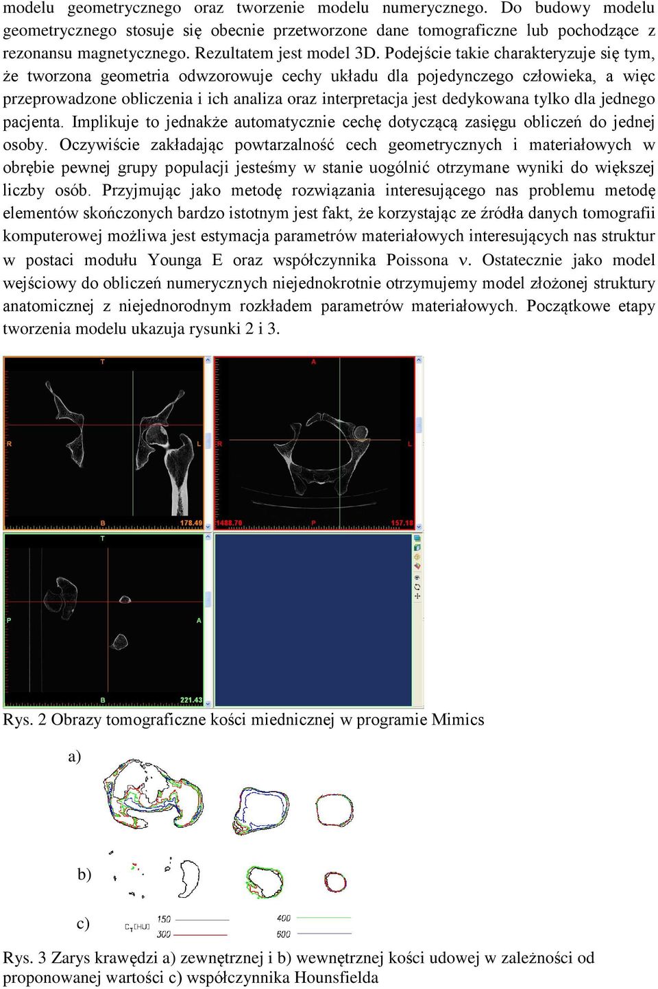 Podejście takie charakteryzuje się tym, że tworzona geometria odwzorowuje cechy układu dla pojedynczego człowieka, a więc przeprowadzone obliczenia i ich analiza oraz interpretacja jest dedykowana