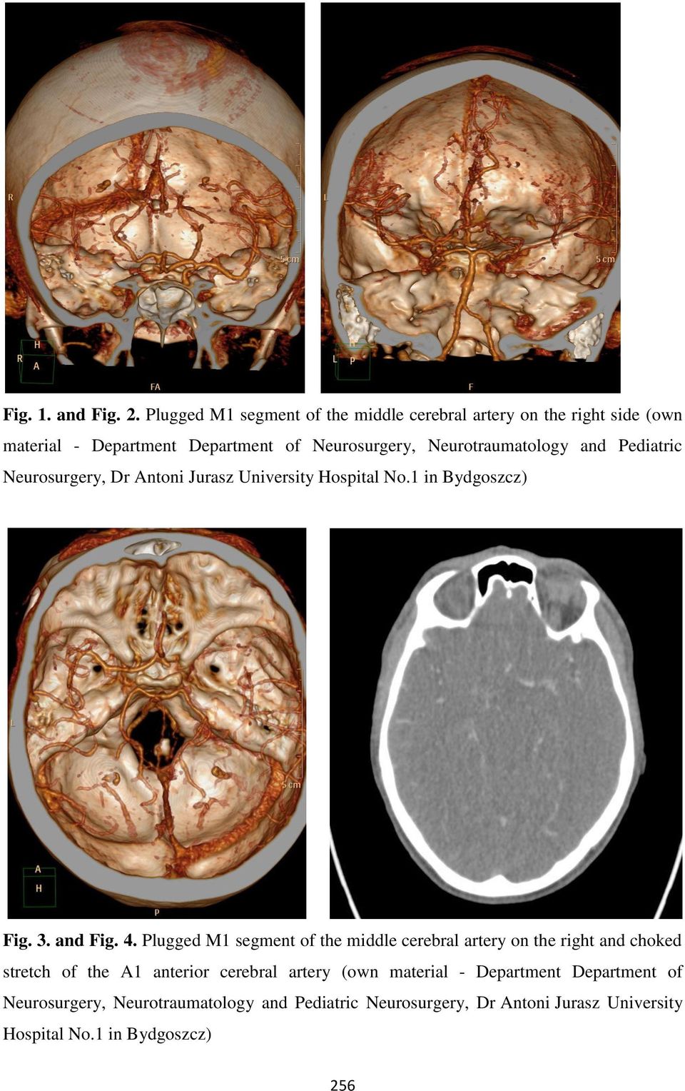 Neurotraumatology and Pediatric Neurosurgery, Dr Antoni Jurasz University Hospital No.1 in Bydgoszcz) Fig. 3. and Fig. 4.