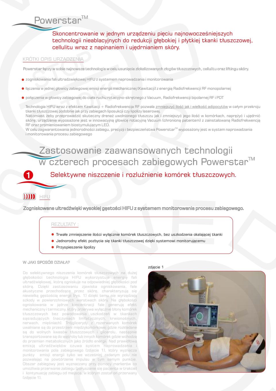 zogniskowania fali ultradzwiękowej HIFU z systemem naprowadzania i monitorowania łączenia w jednej głowicy zabiegowej emisji energii mechanicznej (Kawitacji) z energią Radiofrekwencji RF monopolarnej