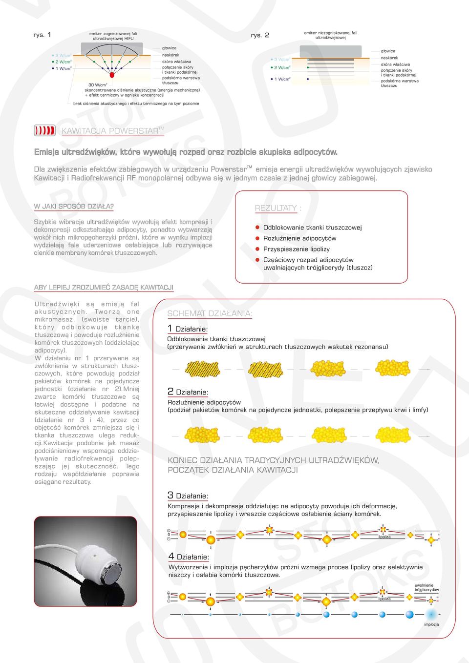 akustyczne (energia mechaniczna) + efekt termiczny w ognisku koncentracji 3 W/cm W/cm 1 W/cm głowica połączenie skóry i tkanki podskórnej podskórna warstwa tłuszczu brak ciśnienia akustycznego i