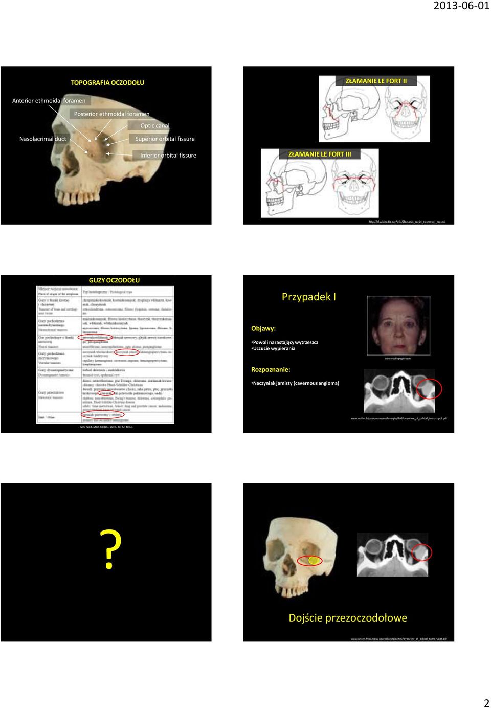 org/wiki/złamania_części_twarzowej_czaszki GUZY OCZODOŁU Przypadek I Powoli narastający wytrzeszcz Uczucie wypierania www.oechography.