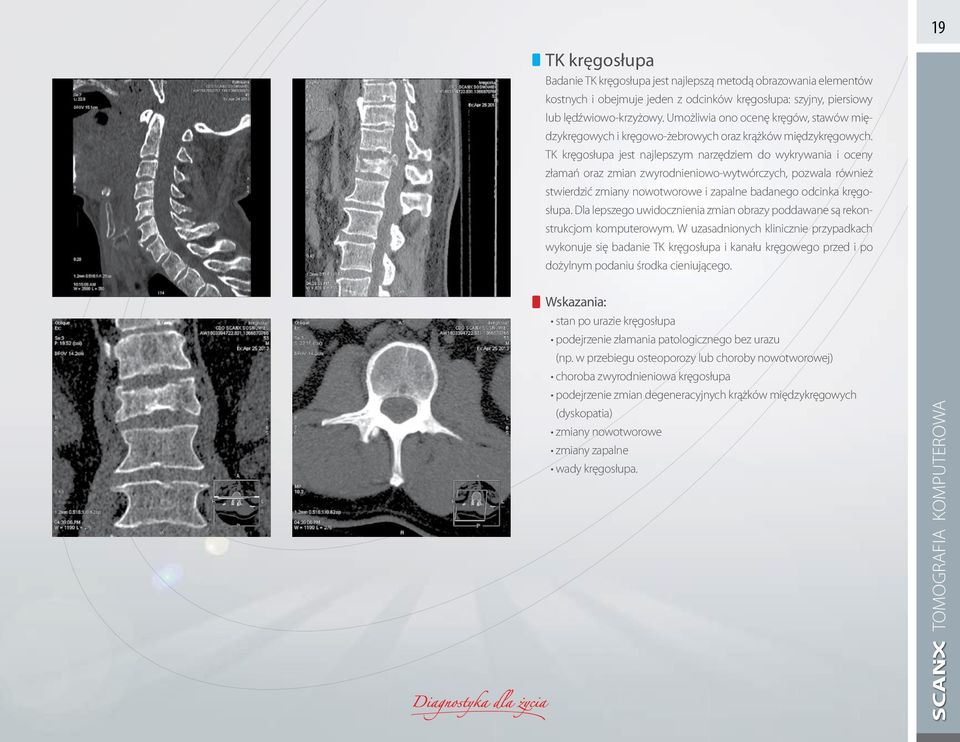TK kręgosłupa jest najlepszym narzędziem do wykrywania i oceny złamań oraz zmian zwyrodnieniowo-wytwórczych, pozwala również stwierdzić zmiany nowotworowe i zapalne badanego odcinka kręgosłupa.