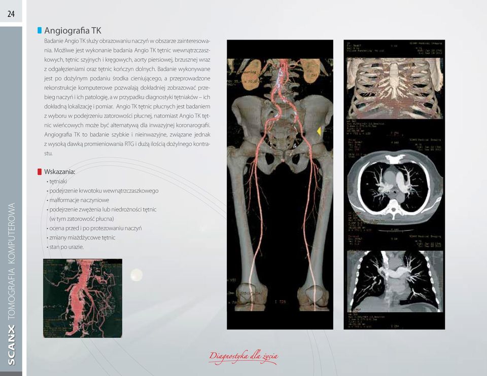 Badanie wykonywane jest po dożylnym podaniu środka cieniującego, a przeprowadzone rekonstrukcje komputerowe pozwalają dokładniej zobrazować przebieg naczyń i ich patologię, a w przypadku diagnostyki