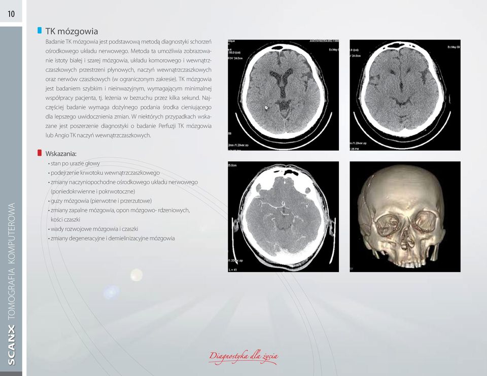 zakresie). TK mózgowia jest badaniem szybkim i nieinwazyjnym, wymagającym minimalnej współpracy pacjenta, tj. leżenia w bezruchu przez kilka sekund.