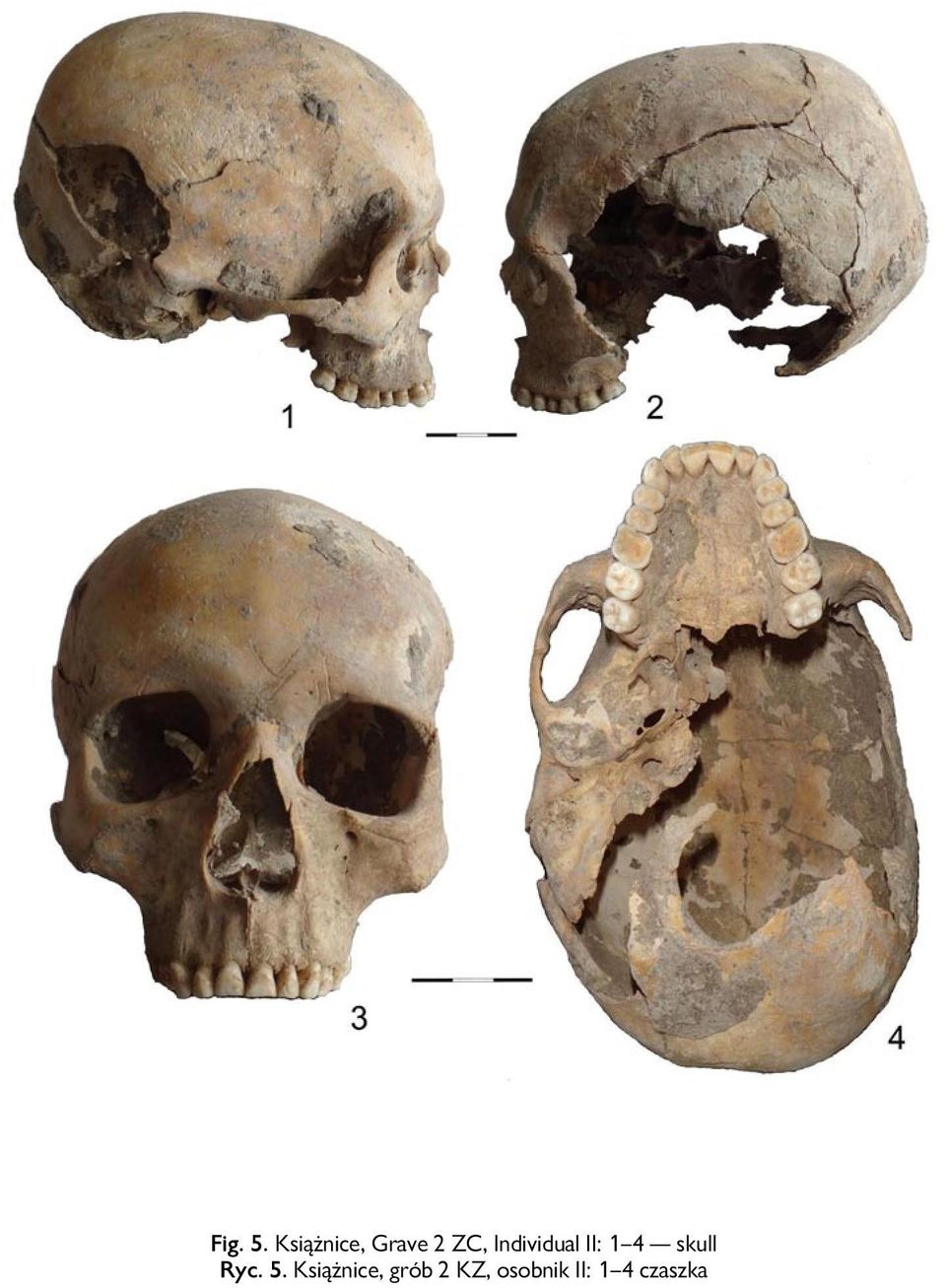 Individual II: 1 4 skull