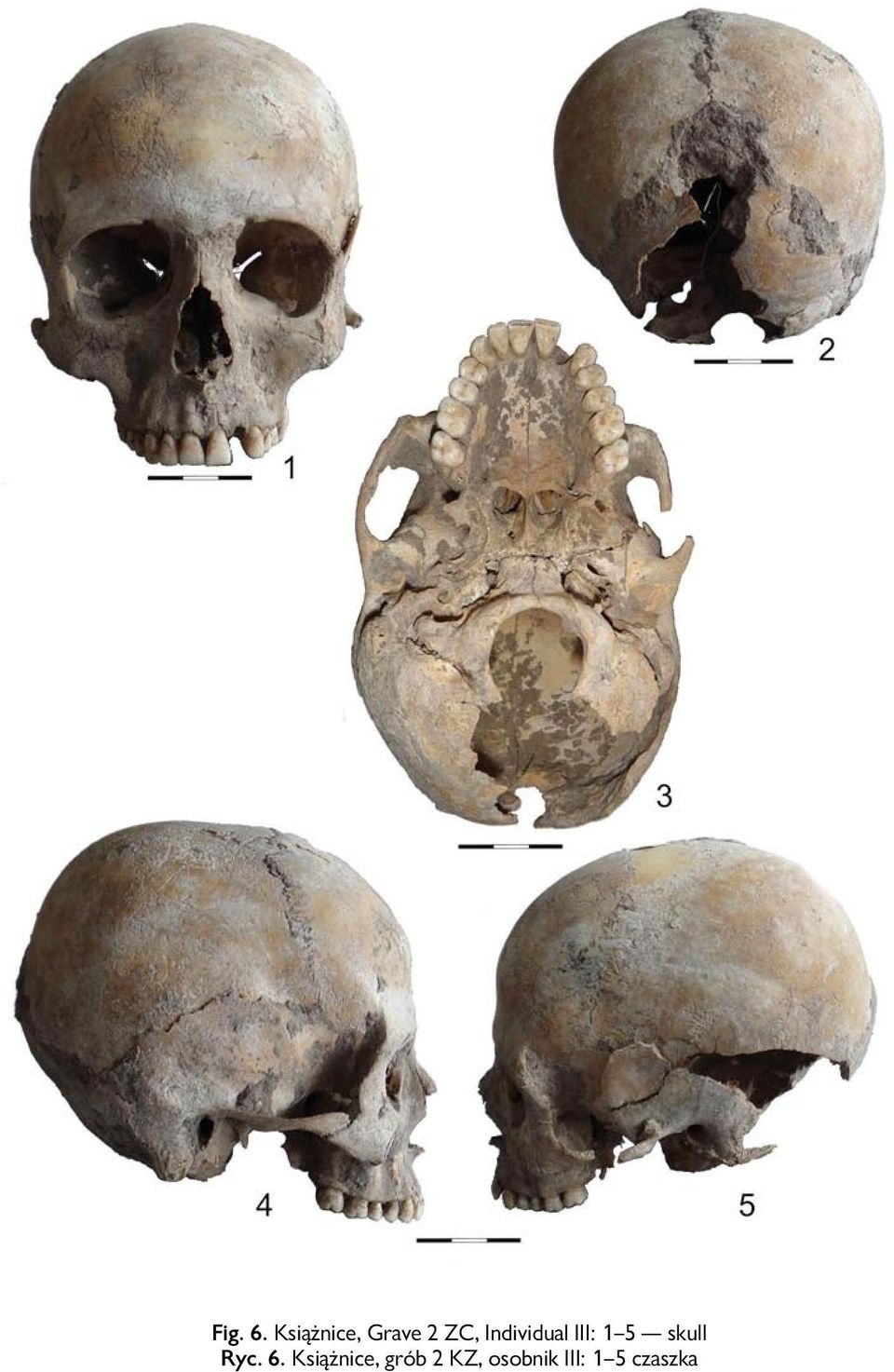 Individual III: 1 5 skull