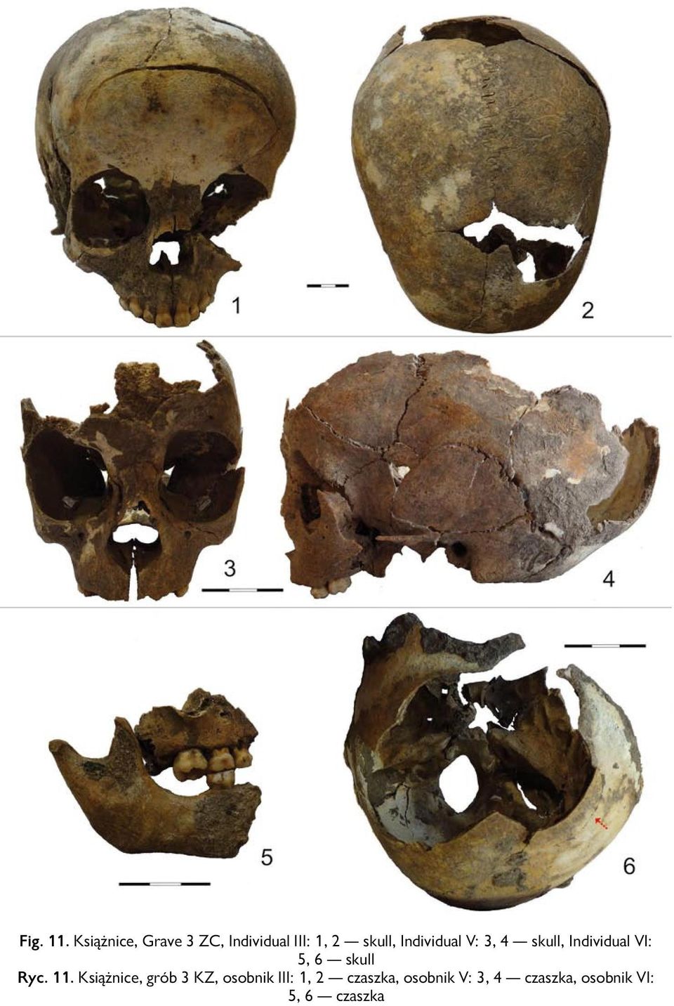 Individual V: 3, 4 skull, Individual VI: 5, 6 skull