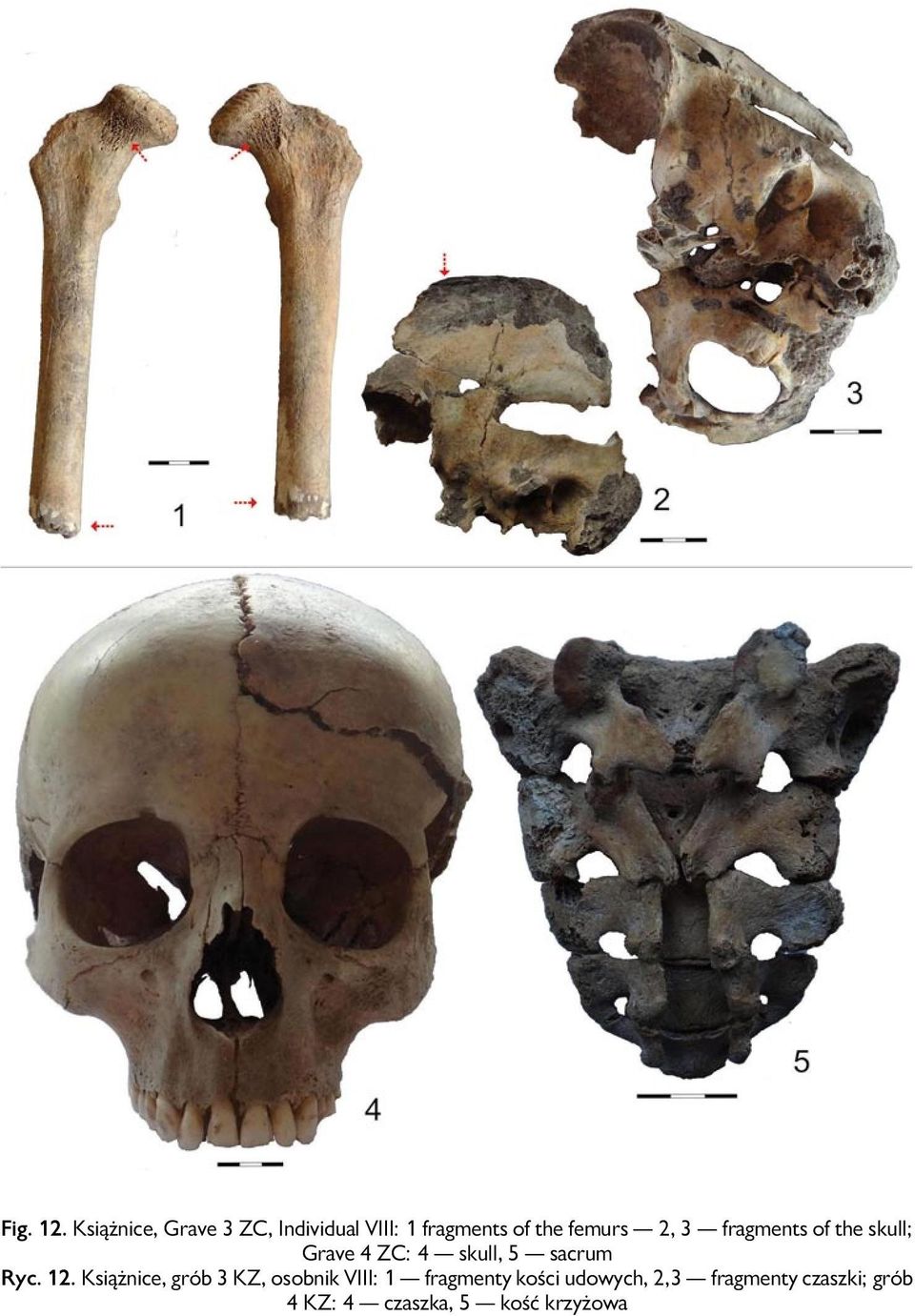2, 3 fragments of the skull; Grave 4 ZC: 4 skull, 5 sacrum Ryc. 12.