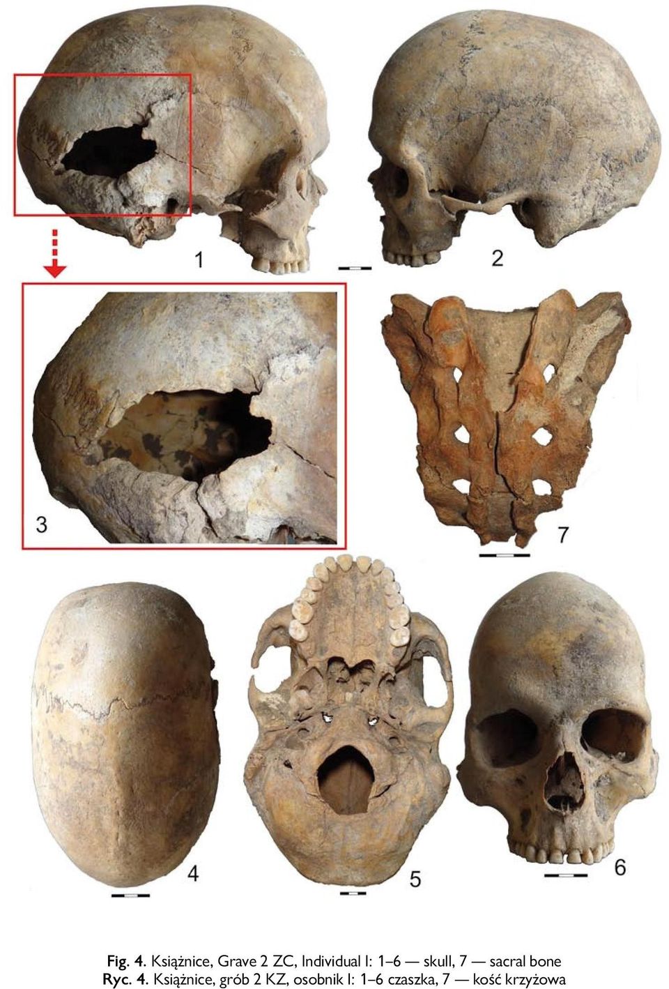I: 1 6 skull, 7 sacral bone Ryc. 4.