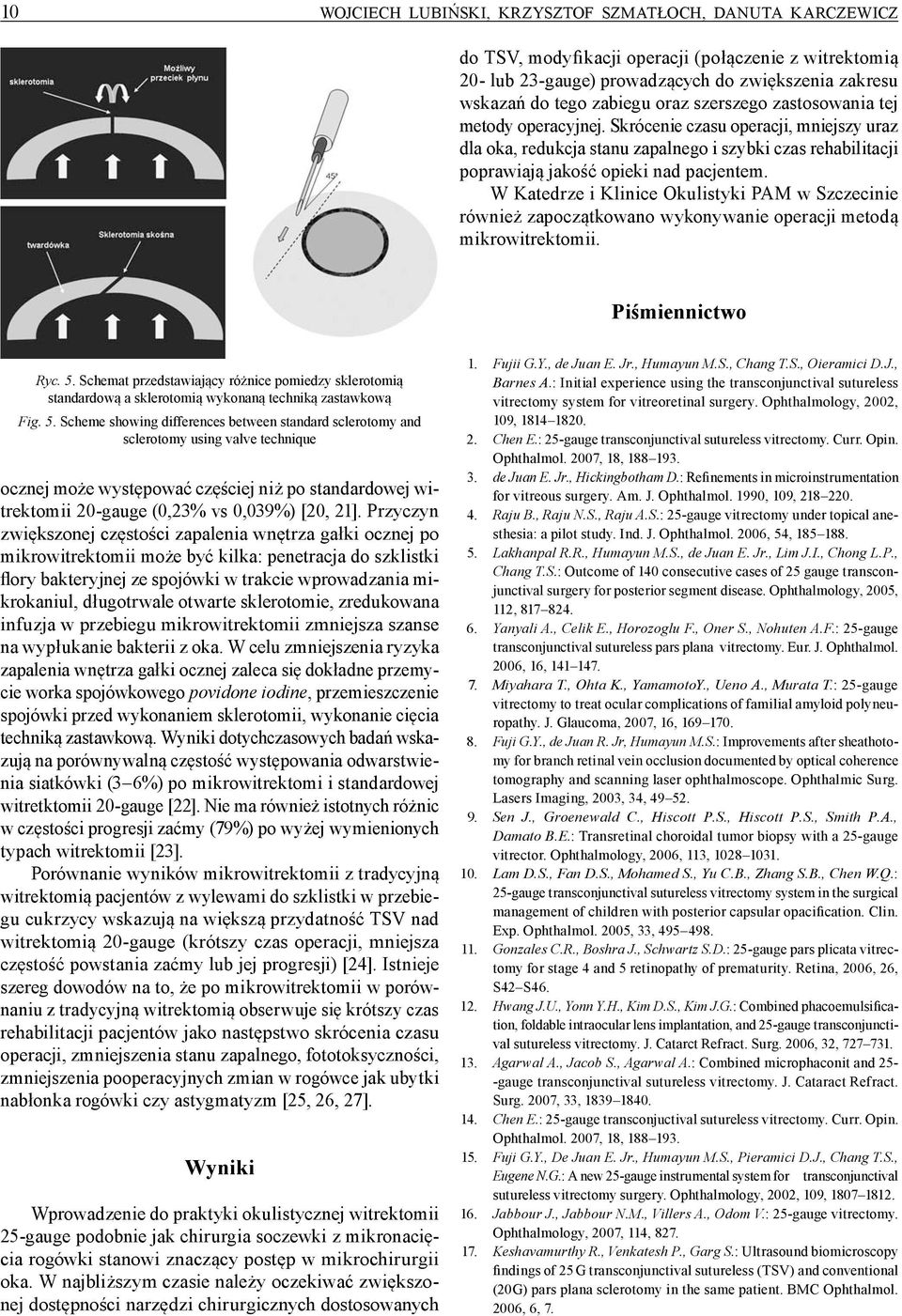 W Katedrze i Klinice Okulistyki PAM w Szczecinie również zapoczątkowano wykonywanie operacji metodą mikrowitrektomii. Piśmiennictwo Ryc. 5.