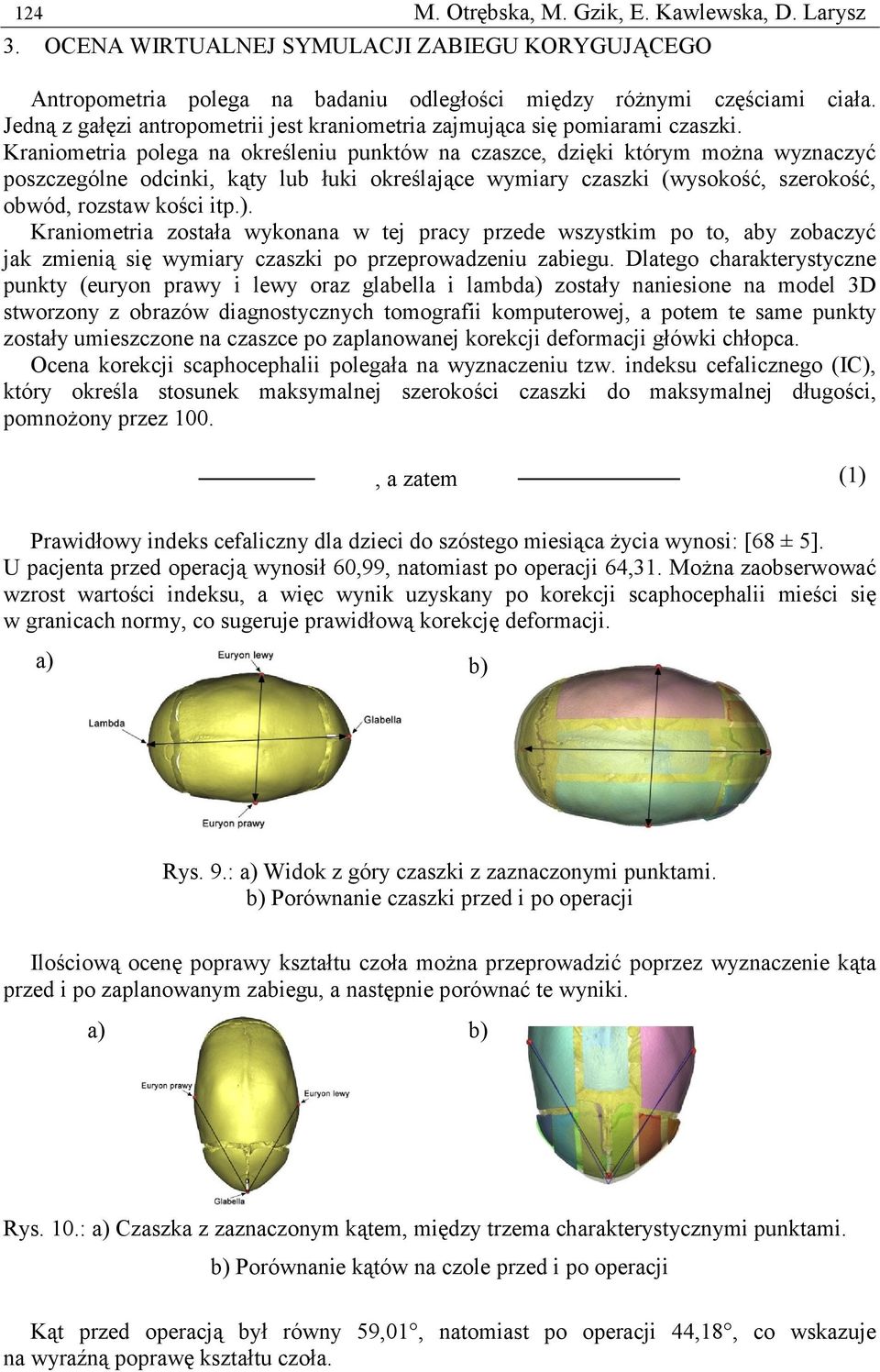 Kraniometria polega na określeniu punktów na czaszce, dzięki którym można wyznaczyć poszczególne odcinki, kąty lub łuki określające wymiary czaszki (wysokość, szerokość, obwód, rozstaw kości itp.).