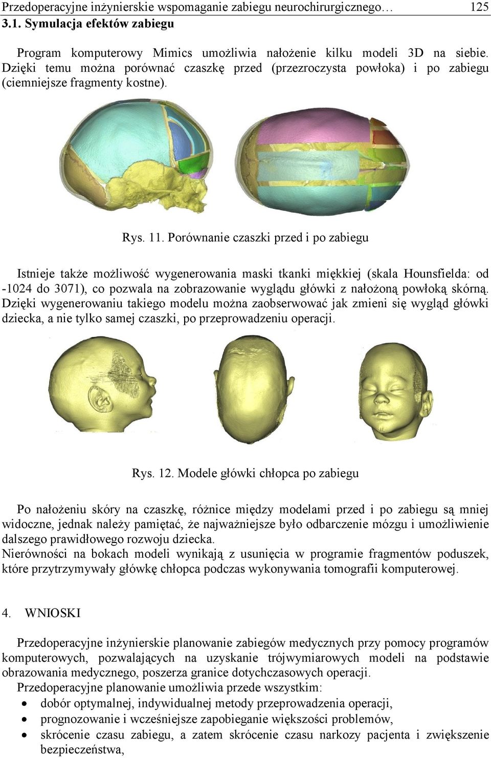 Porównanie czaszki przed i po zabiegu Istnieje także możliwość wygenerowania maski tkanki miękkiej (skala Hounsfielda: od -1024 do 3071), co pozwala na zobrazowanie wyglądu główki z nałożoną powłoką