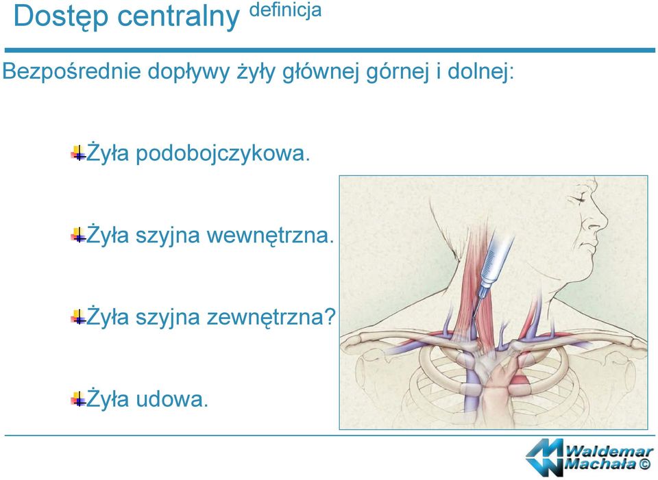 Żyła podobojczykowa.