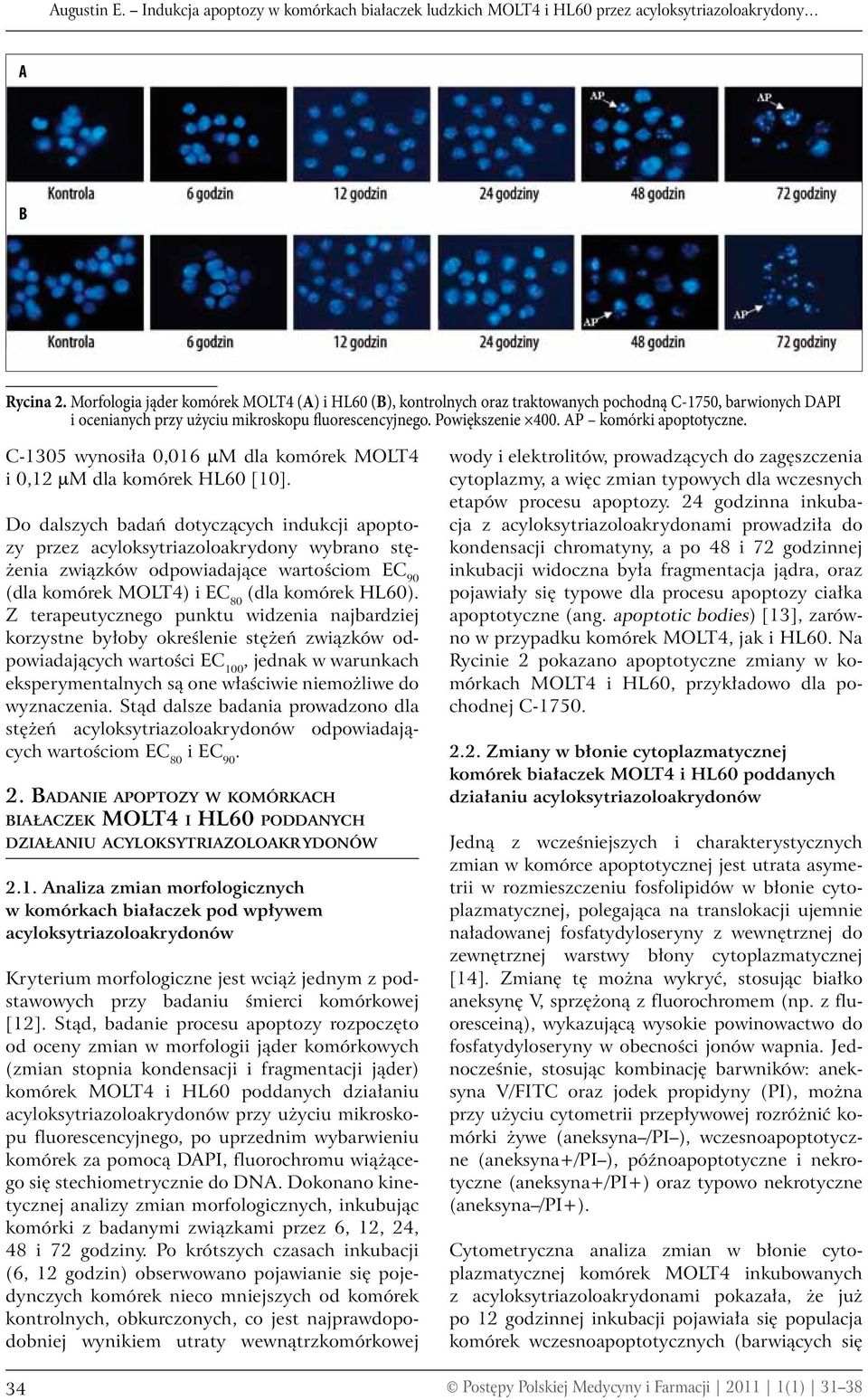 AP komórki apoptotyczne. C-1305 wynosiła 0,016 mm dla komórek MOLT4 i 0,12 mm dla komórek HL60 [10].