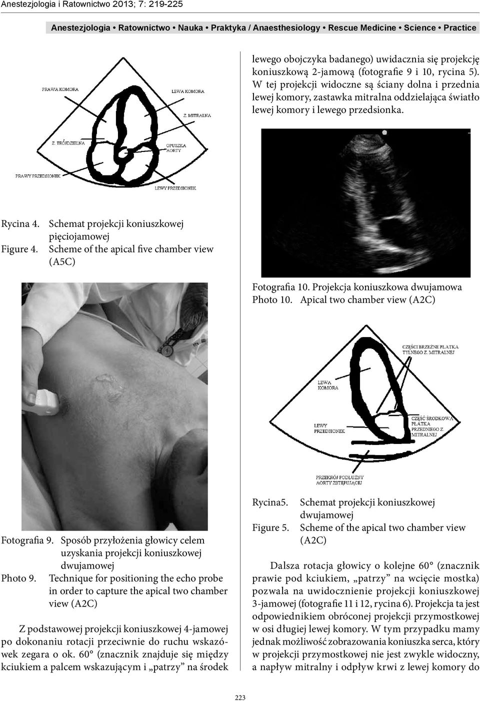 Schemat projekcji koniuszkowej pięciojamowej Figure 4. Scheme of the apical five chamber view (A5C) Fotografia 10. Projekcja koniuszkowa dwujamowa Photo 10. Apical two chamber view (A2C) Fotografia 9.