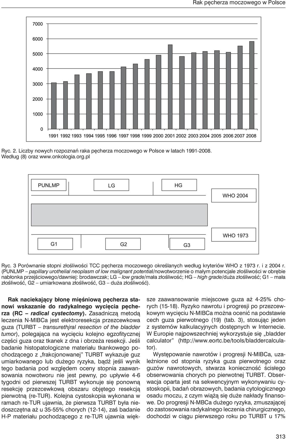 (PUNLMP papillary urothelial neoplasm of low malignant potential/nowotworzenie o małym potencjale złośliwości w obrębie nabłonka przejściowego/dawniej: brodawczak; LG low grade/mała złośliwość; HG