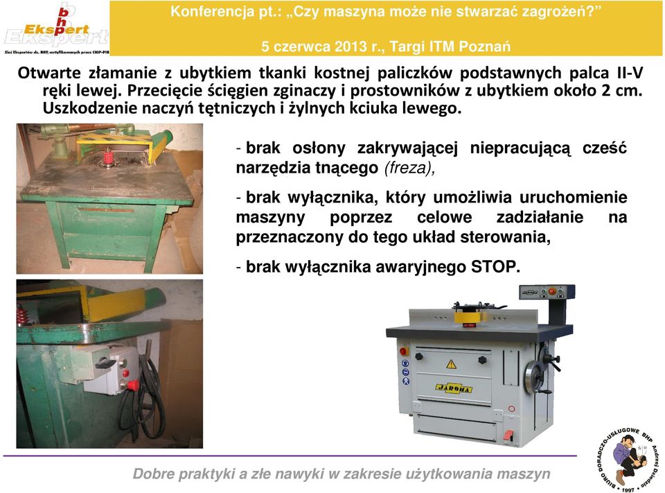 Uszkodzenie naczyń tętniczych i żylnych kciuka lewego.