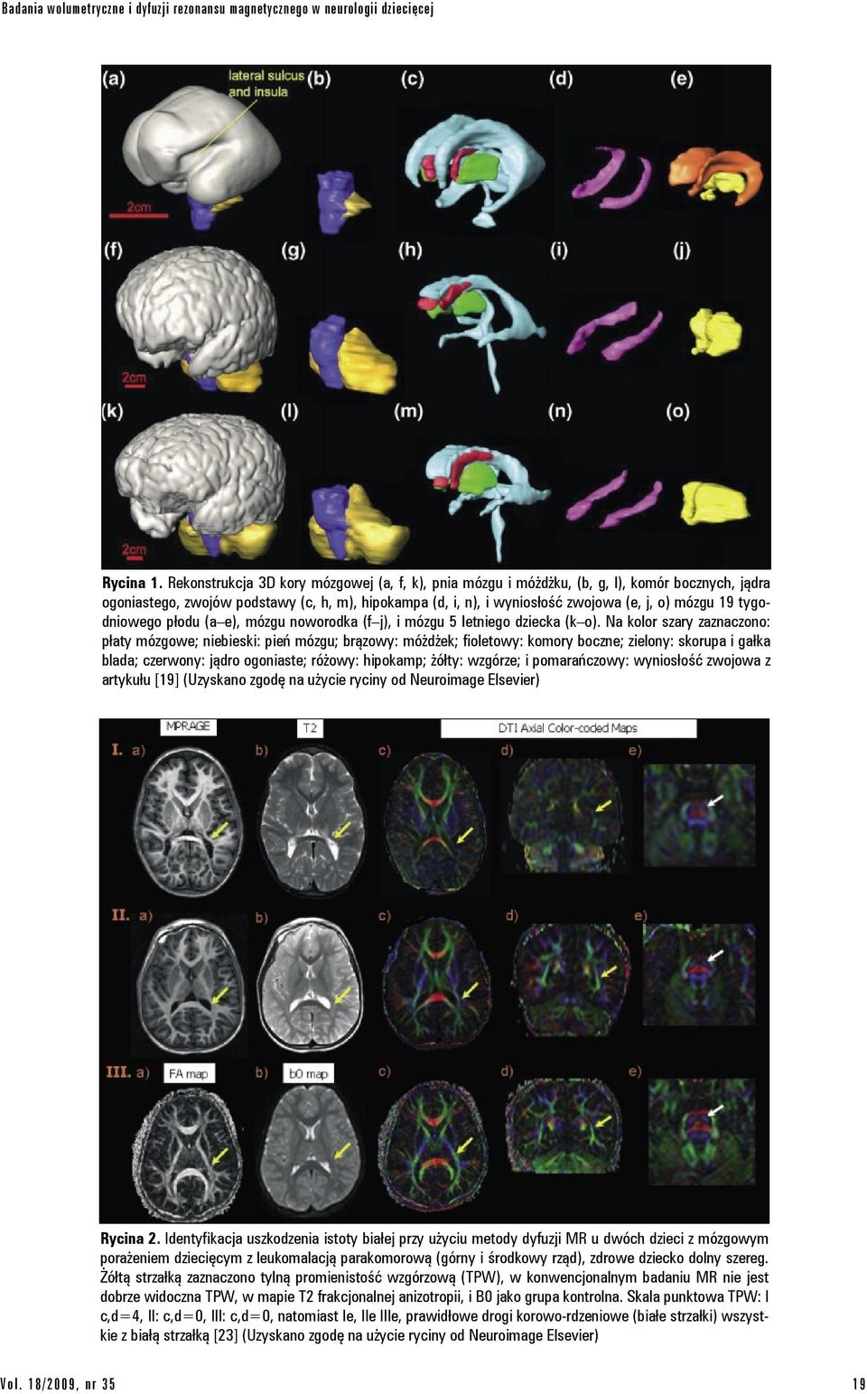 tygodniowego płodu (a e), mózgu noworodka (f j), i mózgu 5 letniego dziecka (k o).