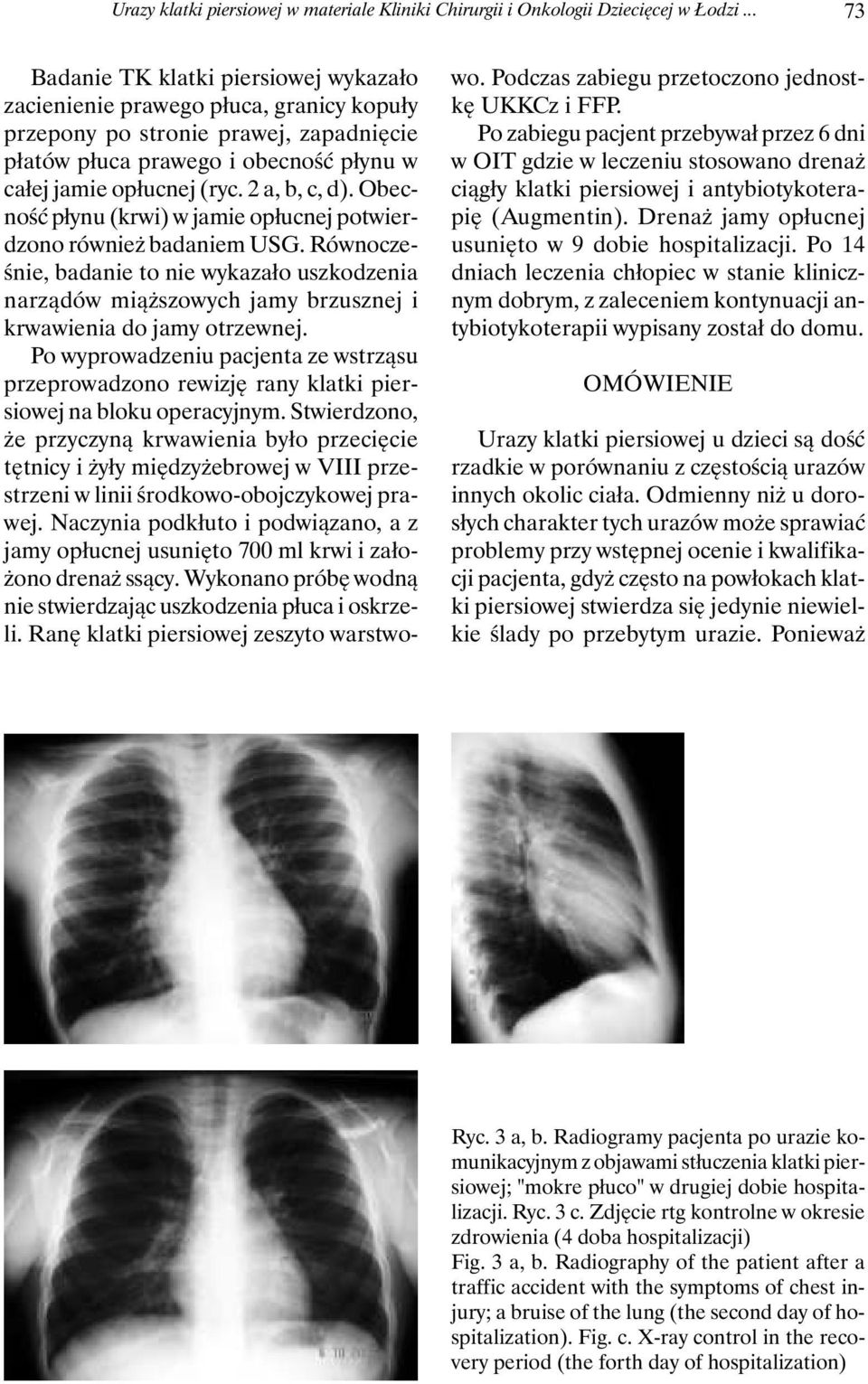 2 a, b, c, d). Obecność płynu (krwi) w jamie opłucnej potwierdzono również badaniem USG.