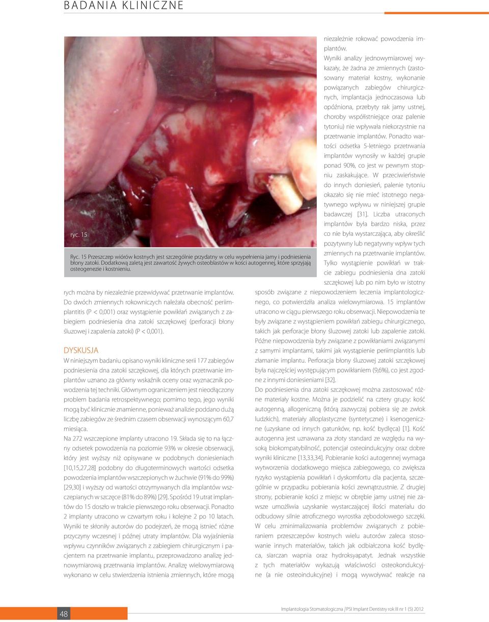 Do dwóch zmiennych rokowniczych należała obecność periimplantitis (P < 0,001) oraz wystąpienie powikłań związanych z zabiegiem podniesienia dna zatoki szczękowej (perforacji błony śluzowej i